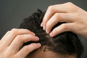 Best Hair Loss Treatment