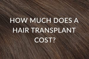 How Much Does A Hair Transplant Cost