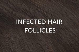 Infected Hair Follicles
