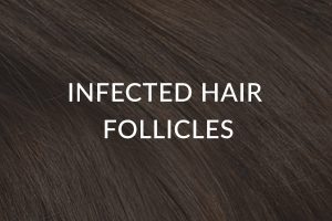 Infected Hair Follicles