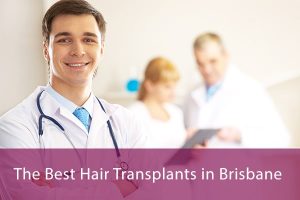 best hair transplants brisbane